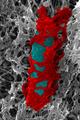 Белок септин формирует «капканы», ограничивающие перемещение бактерий в клетке хозяина