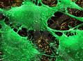 Новые данные об особенностях метаболизма раковых клеток