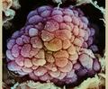 Клетки опухоли и её метастазы активно эволюционируют за счёт большого количества возникающих мутаций