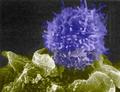 Генетически модифицированные Т-лимфоциты безопасны для лечения ВИЧ-инфицированных больных