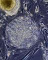 Исключительно стволовые клетки отвечают за восстановление тканей при травмах
