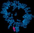 Загадочное путешествие некодирующей РНК Xist по X-хромосоме