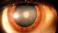 Найден способ за несколько дней вылечить катаракту с помощью глазных капель
